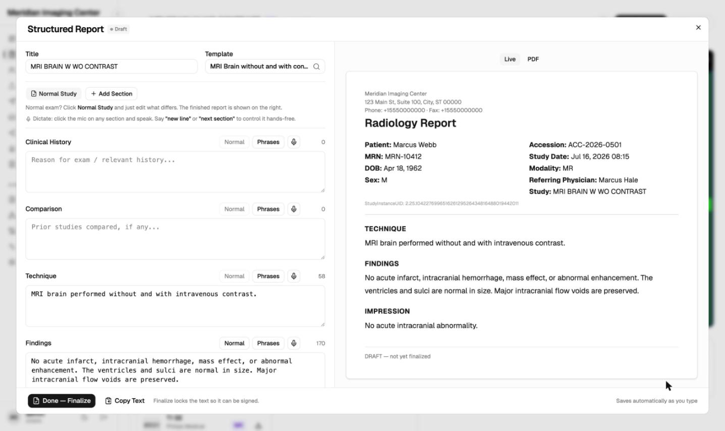 The MiniPACS structured report editor with template and dictation controls next to a live report preview in draft state, on synthetic data.