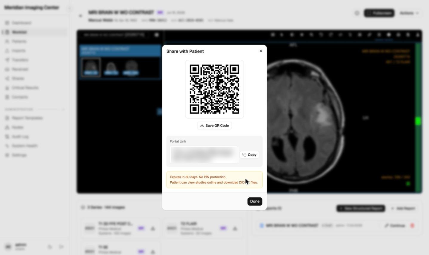 The MiniPACS share dialog with a QR code and portal link that lets a patient view and download the study online, on synthetic data.