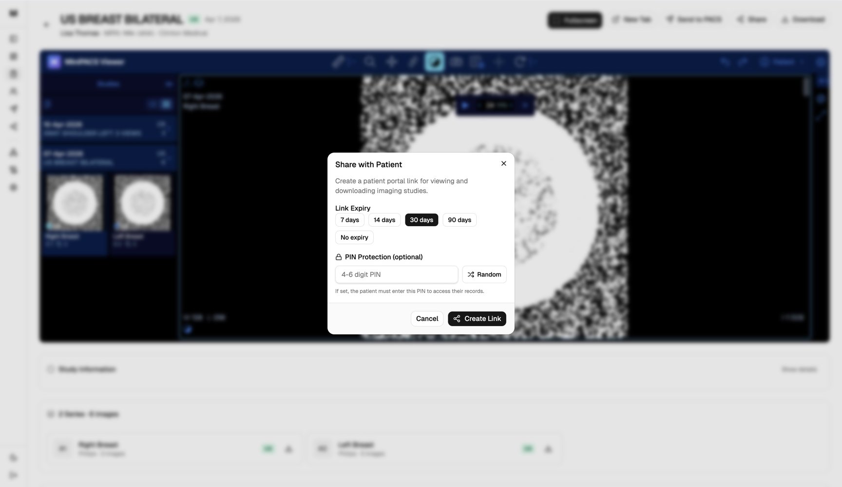 The MiniPACS share-with-patient dialog set to a 30 day link expiry, layered over a blurred browser viewer showing a breast ultrasound study.