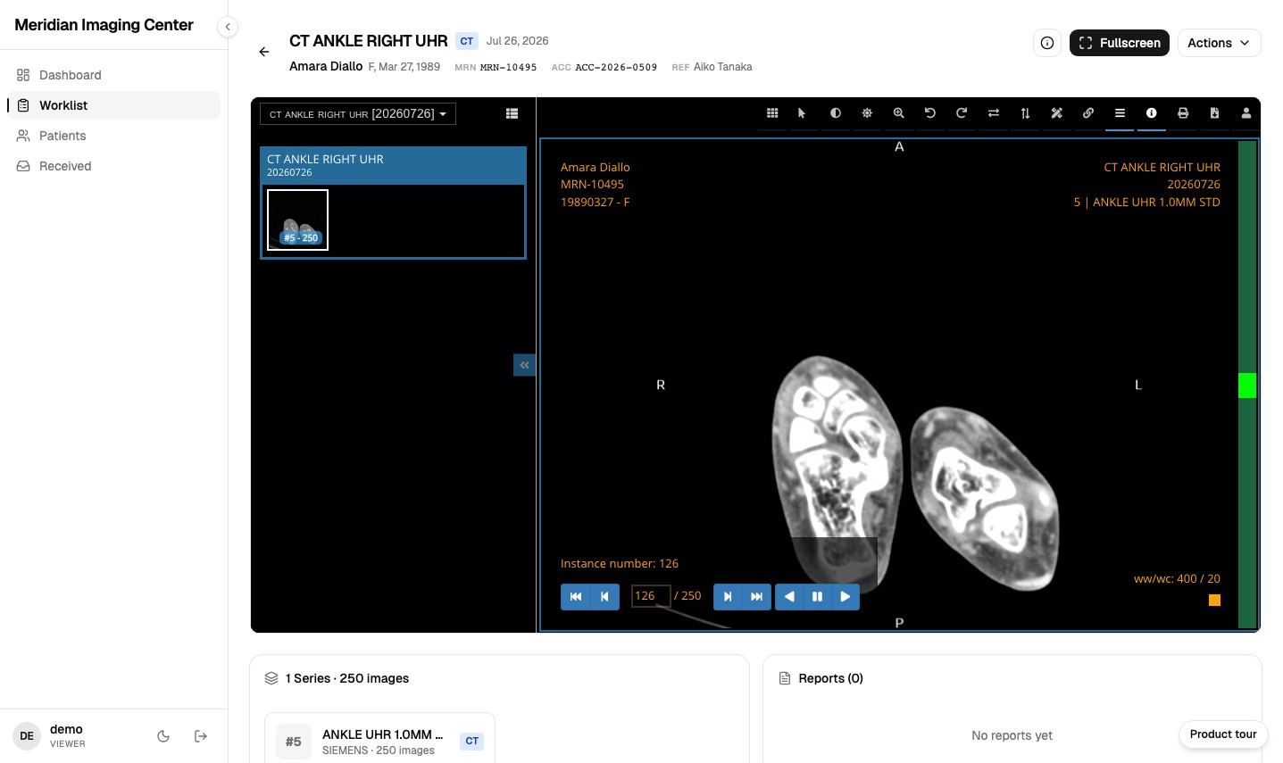 The MiniPACS browser viewer cold-opened on a CT ankle study, showing bone window overlays and cine controls on synthetic data.