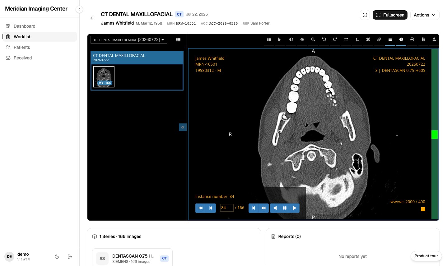 The MiniPACS browser viewer open on a CT dental maxillofacial study, illustrating the zero-install viewer this comparison describes.