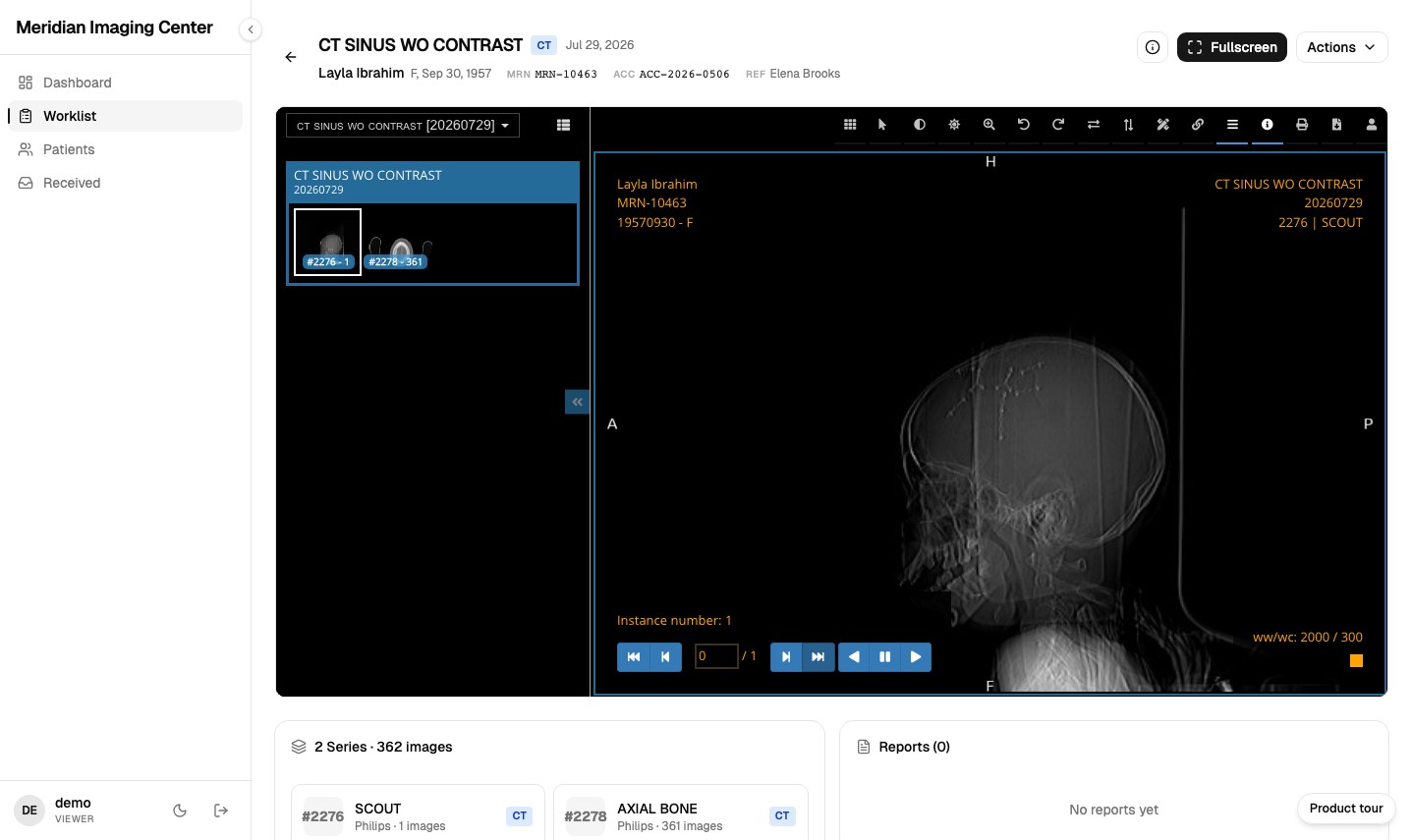 The MiniPACS browser viewer open on a synthetic CT sinus study's scout localizer image, a single sagittal skull view, not a digital X-ray.