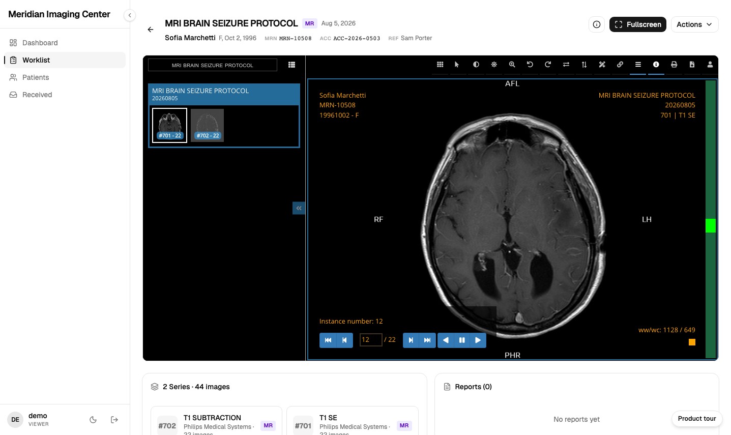 The MiniPACS DICOM viewer opening a synthetic MRI brain seizure protocol study in the browser with series thumbnails and cine controls.