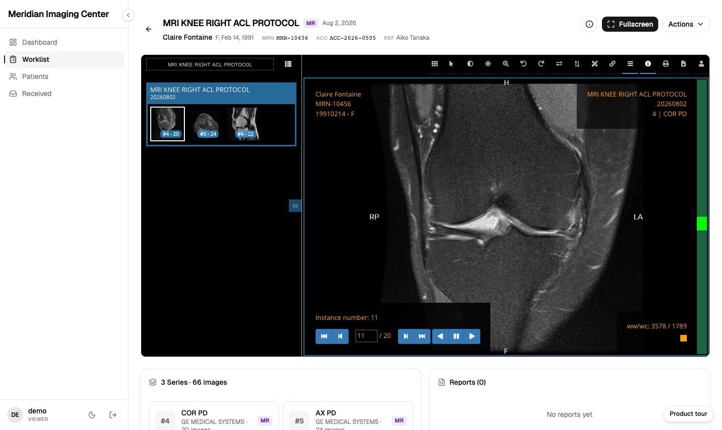 The MiniPACS browser viewer cold-opened on an MRI knee ACL protocol study, showing series thumbnails and window level overlays on synthetic data.