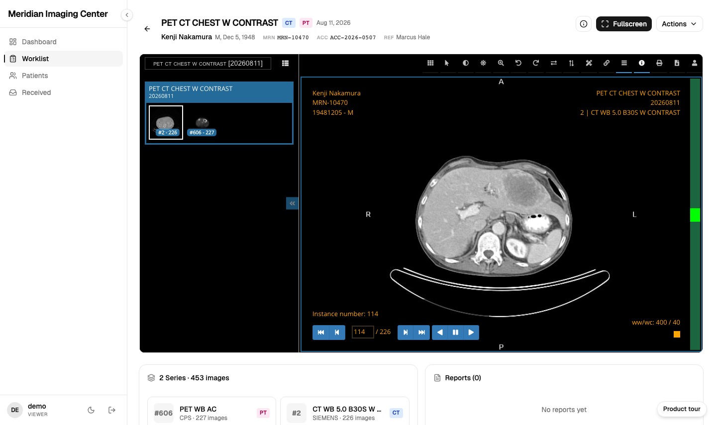 The MiniPACS DICOM viewer open on a PET CT chest study in a browser tab, showing a contrast-enhanced CT slice and series thumbnails.