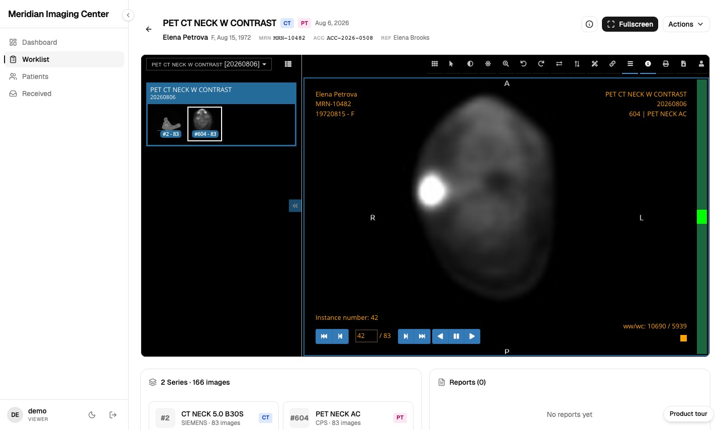 The MiniPACS DICOM viewer with series thumbnails and cine controls, shown on a synthetic PET/CT neck study rather than ultrasound imaging.